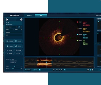恒宇医疗OCT系统医疗影像软件界面设计