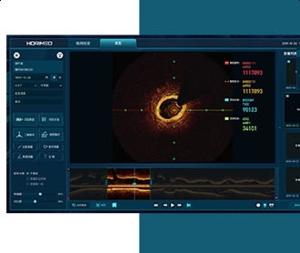 恒宇医疗OCT系统医疗影像软件界面设计