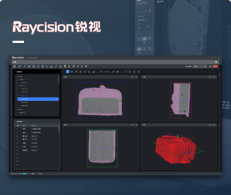 锐视医疗CT分析软件界⾯设计